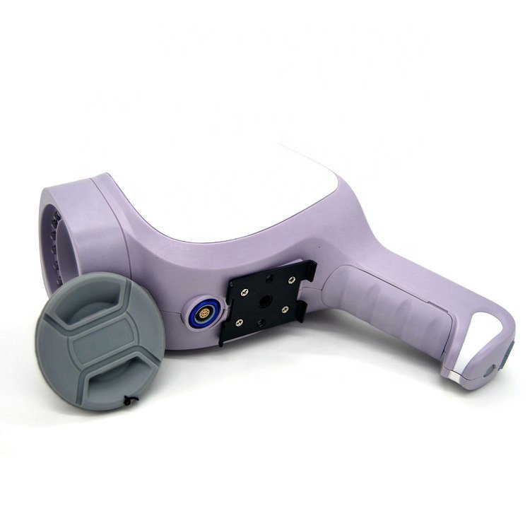 Portable Gynaecology Digital Colposcope System NEUCE07