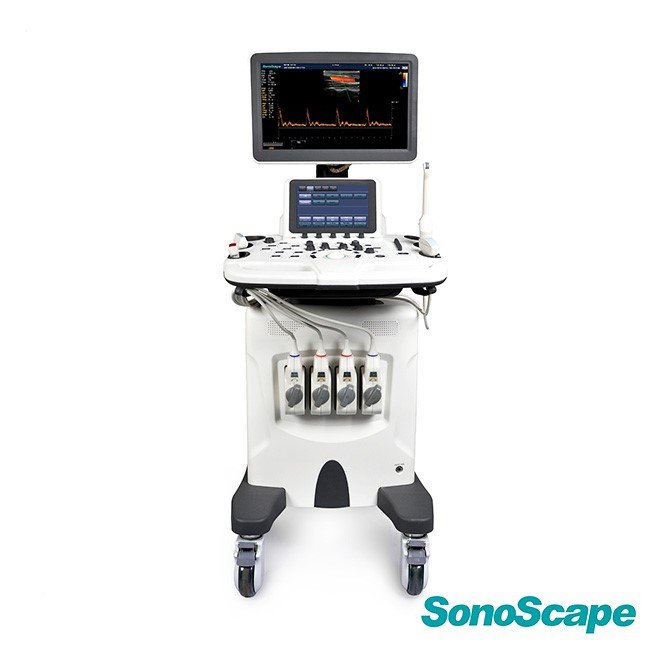 Endovaginal Ultrasound SonoScape S30