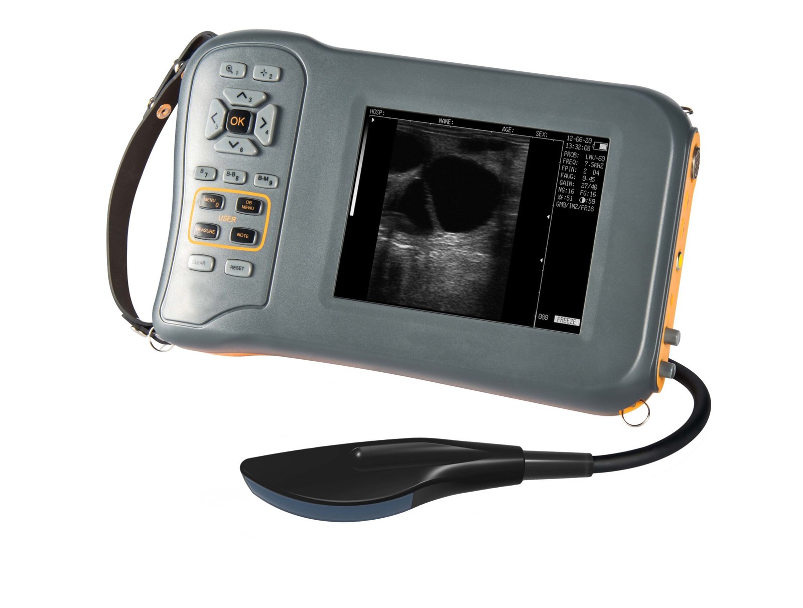 Mini Portable Veterinary Black and White Ultrasound Machine NEUVU42