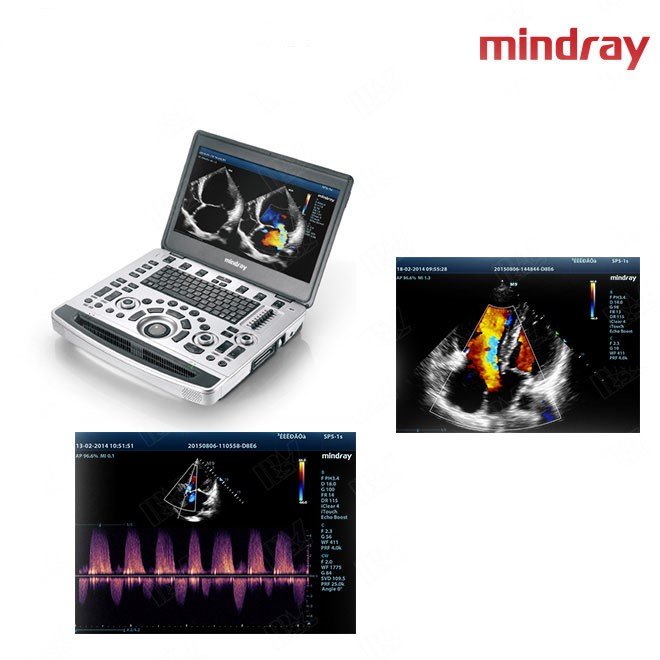 Doppler Scan Test Mindray M9