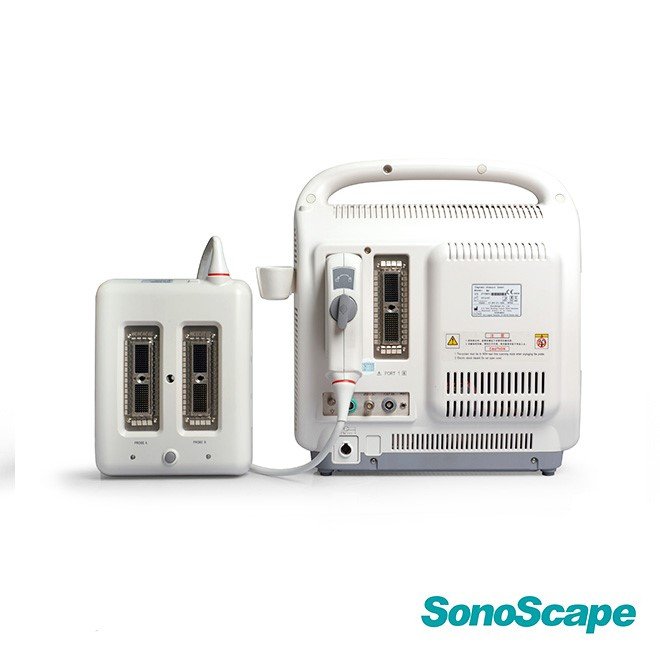 4D Ultrasound SonoScape S6