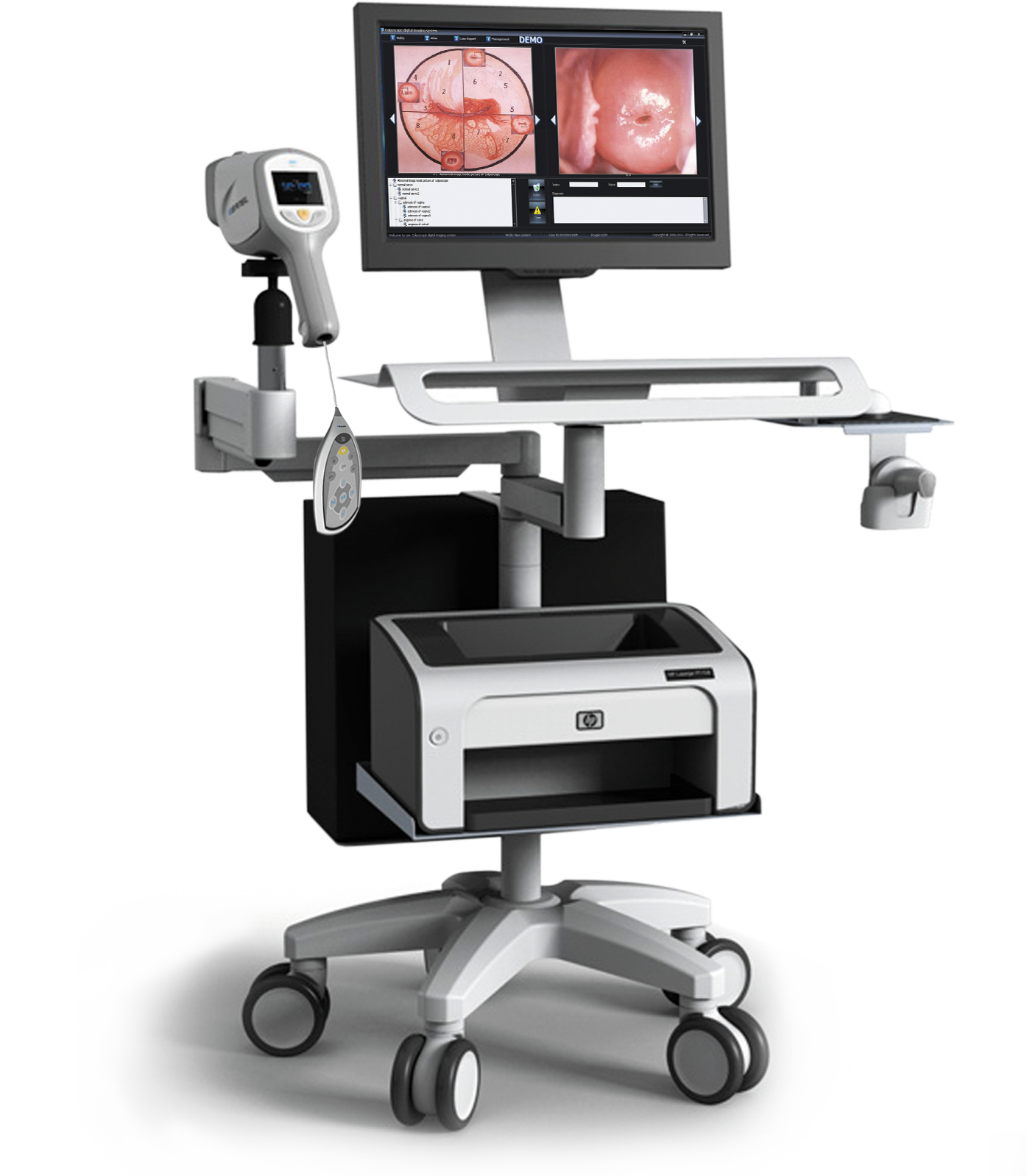 Multi-functional Trolley Colposcope Video Machine NEUCE08