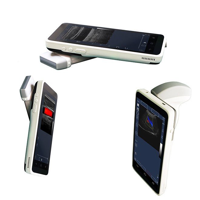 Mini pocket-sized Ultrasound Scan Machine NEUMU04