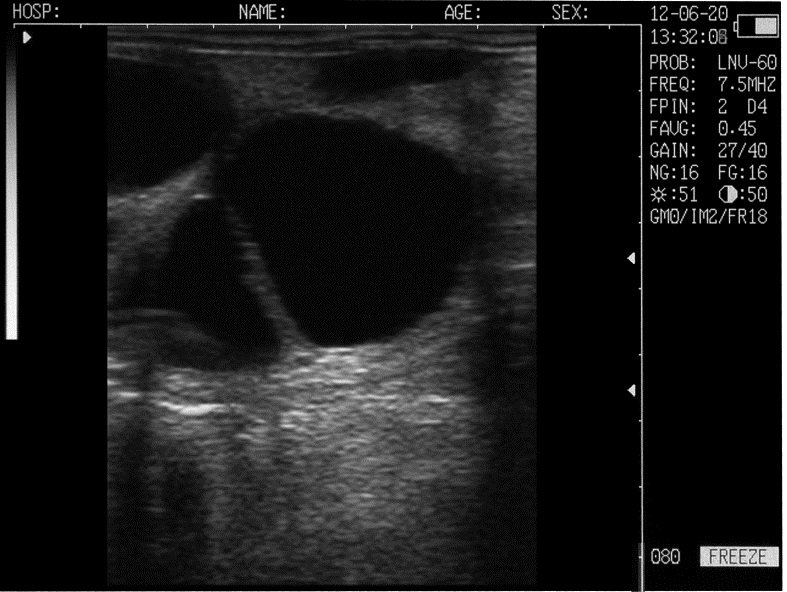 Mini Portable Veterinary Black and White Ultrasound Machine NEUVU42