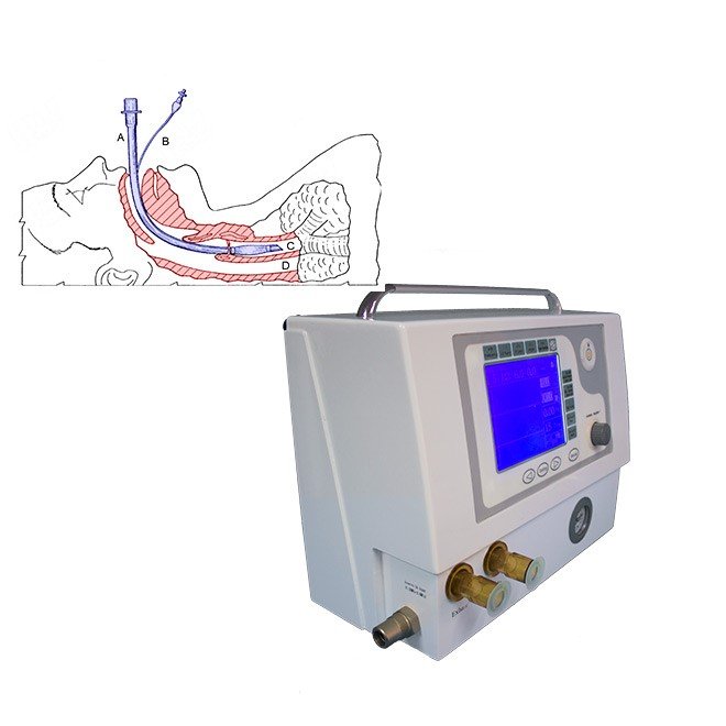 ICU Ventilator Machine NEUPA01