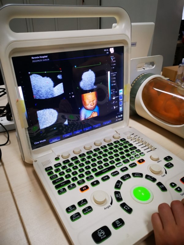 Portable Color Doppler System NEUCU60