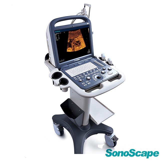 Ultrasound SonoScape S2