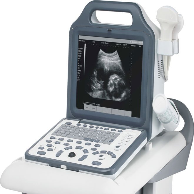 Portable Digital Laptop Ultrasound Scanner NEUPU50