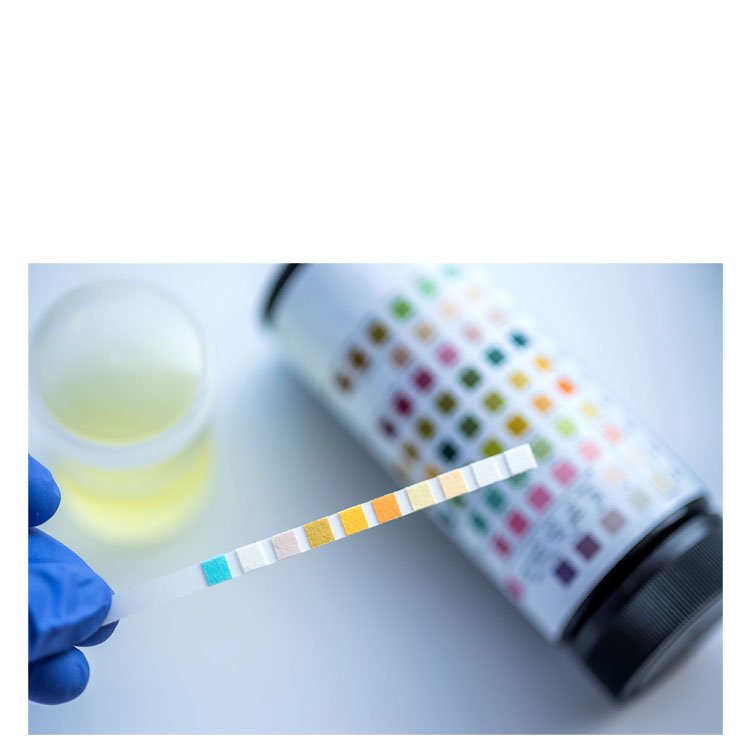 Open Reagent Urine Analyzer Machine NEUBW01