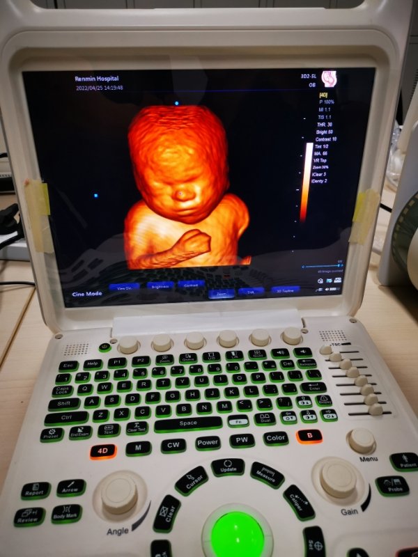 Portable Color Doppler System NEUCU60