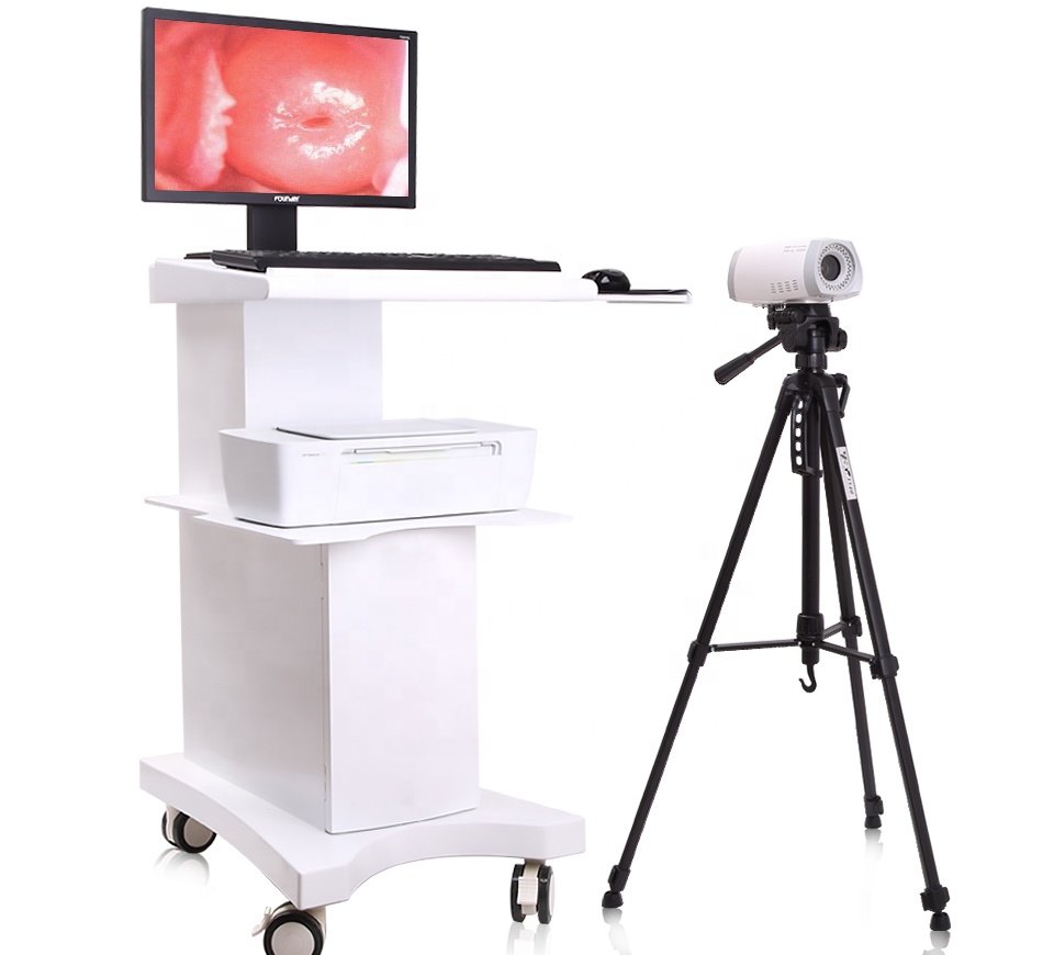 Colposcope Video Machine for Gynaecology NEUCE06