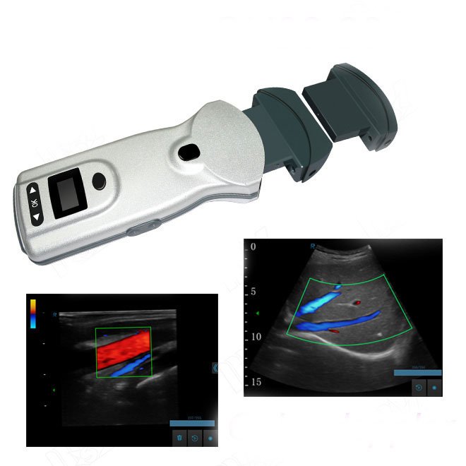 Doppler Wireless Thyroid Ultrasound Scan NEUCU89