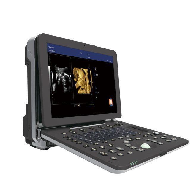 Professional Laptop 4D Color Ultrasound Scanner NEUCU64