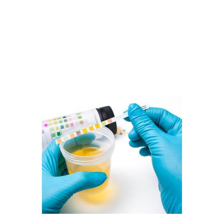Open Reagent Urine Analyzer Machine NEUBW01