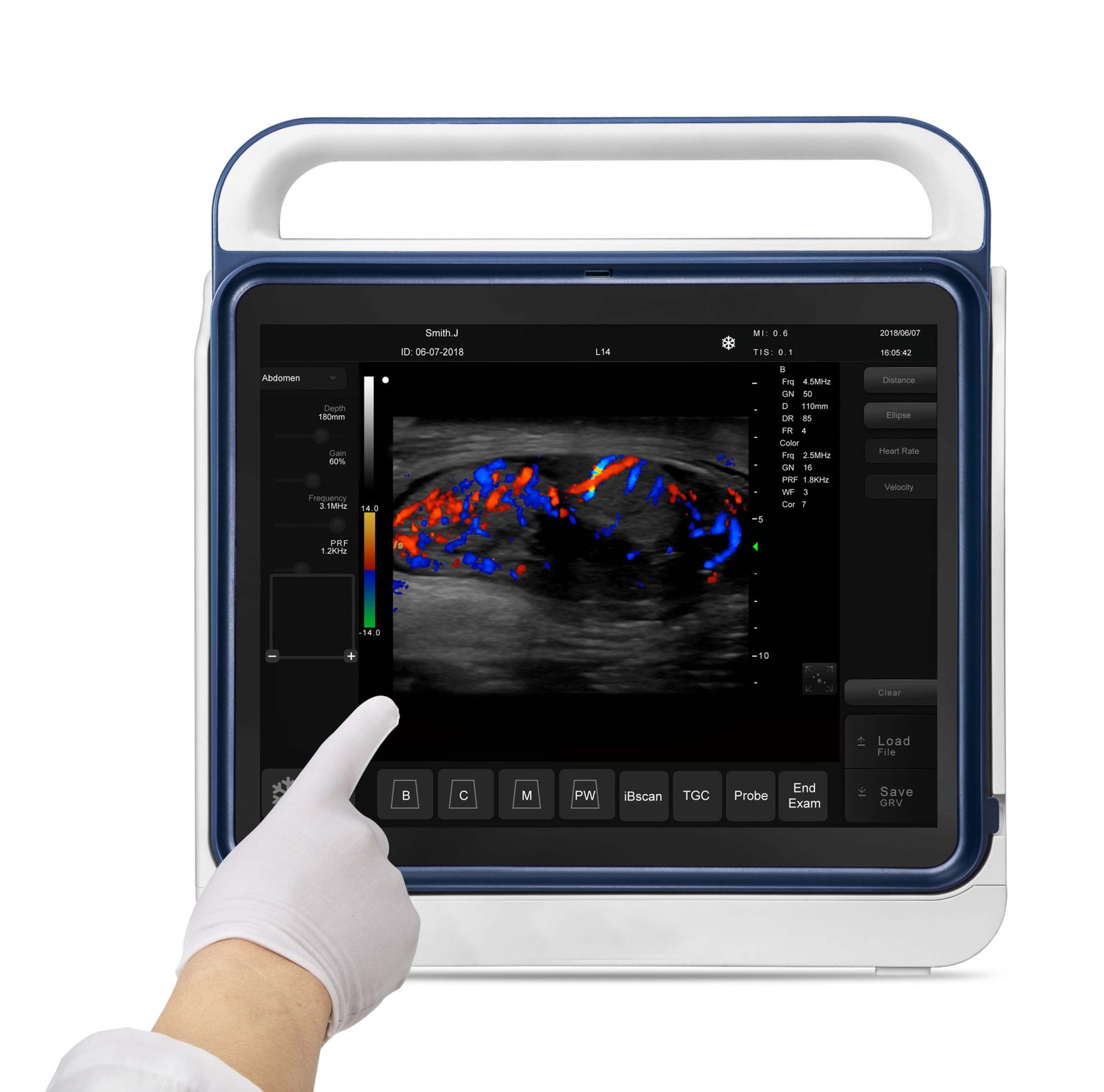 Pad Touch Veterinary Series Ultrasound System Machine NEUVU45