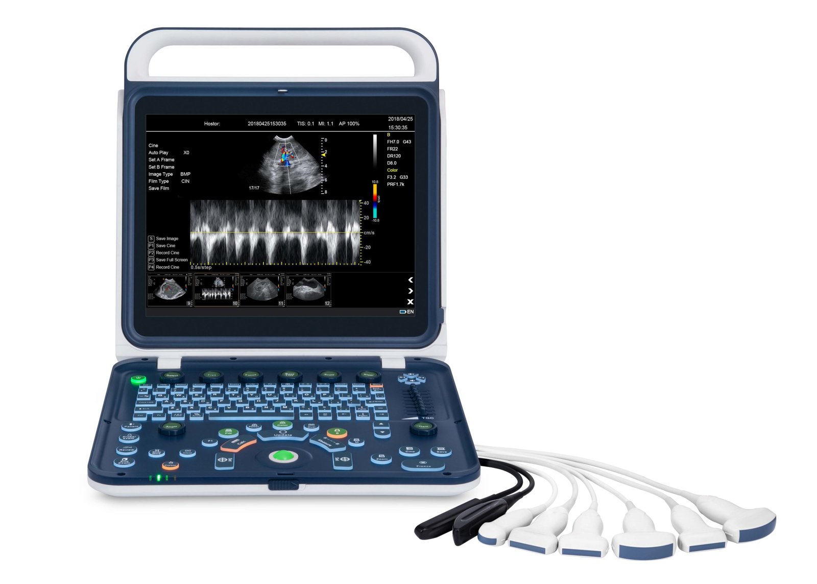 Hand Carried Color Doppler Ultrasound Machine For Vet NEUVU41