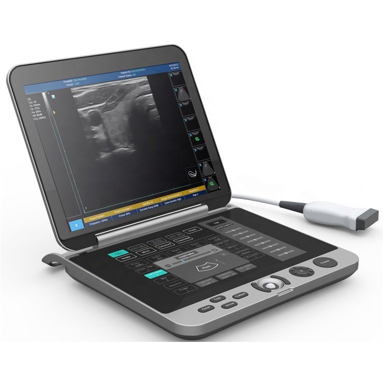 Laptop Ultrasound Machine with Touch Screen Keyboard NEUPU44