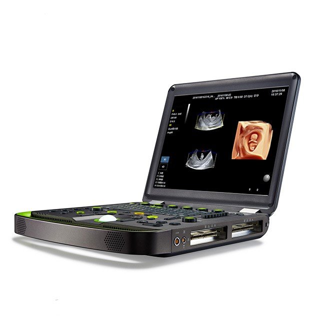 Static 3D/4D Doppler Ultrasound NEUCU56
