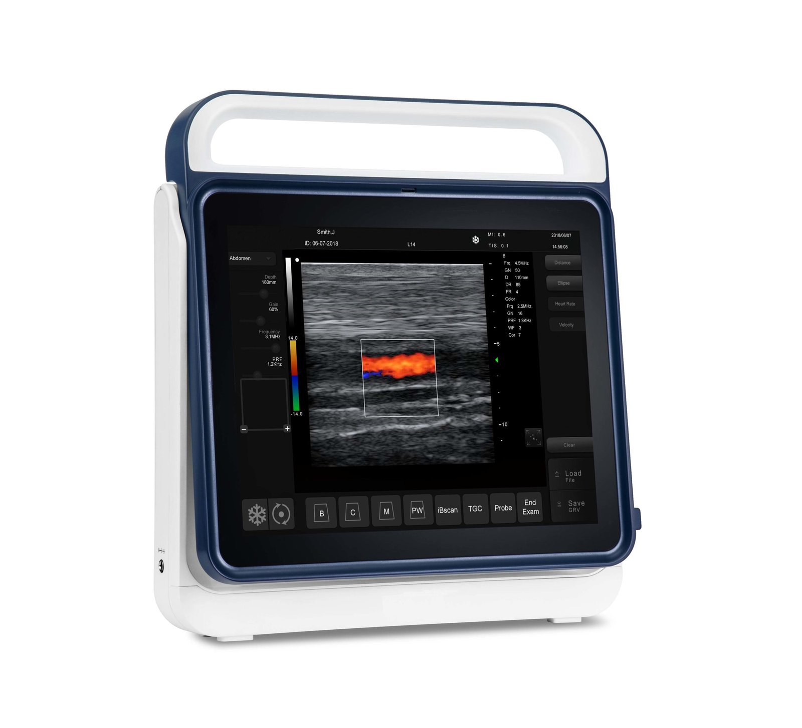 Pad Touch Veterinary Series Ultrasound System Machine NEUVU45