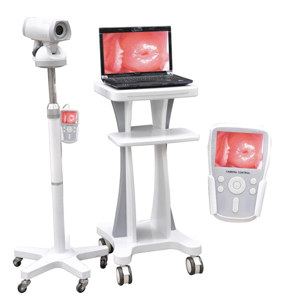 Multi-functional Trolley Colposcope Video Machine NEUCE08
