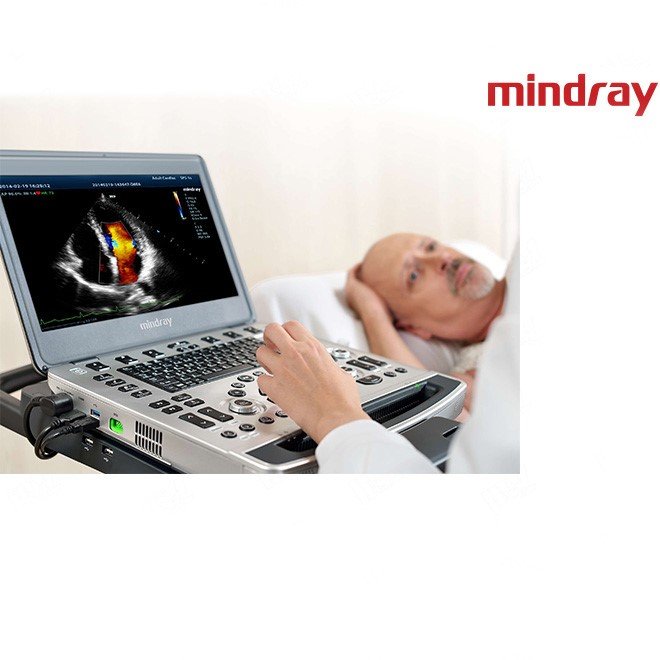 Doppler Scan Test Mindray M9