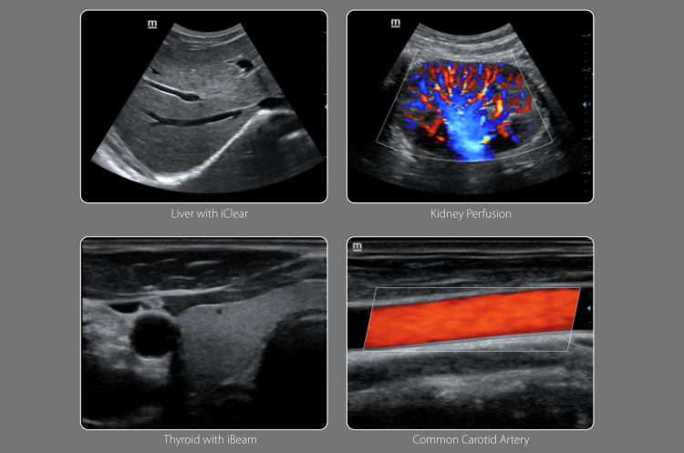 Cardiac 4D Color Doppler Ultrasound Mindray DC-30