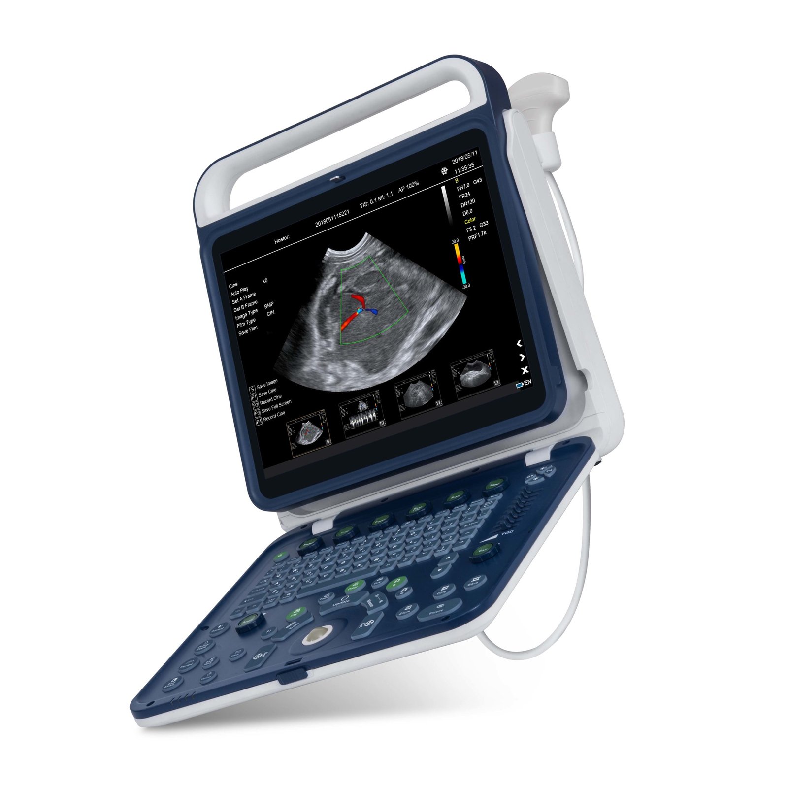 Hand Carried Color Doppler Ultrasound Machine For Vet NEUVU41