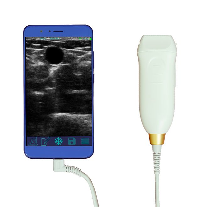 Portable Mini Ultrasound Machine NEUMU09