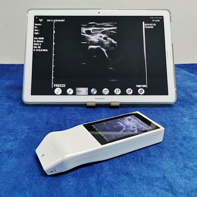 Small Wireless Probe Ultrasound Machine NEUPU74