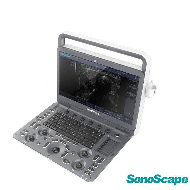 Doppler Ultrasound Scan Sonoscape E2