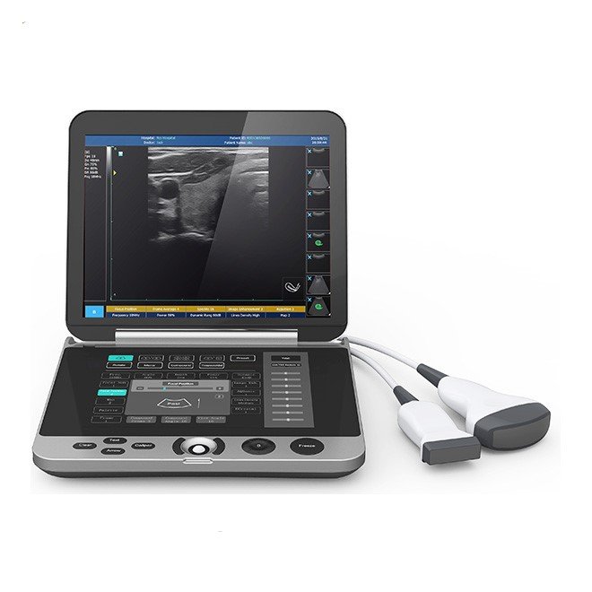 Laptop Ultrasound Machine with Touch Screen Keyboard NEUPU44
