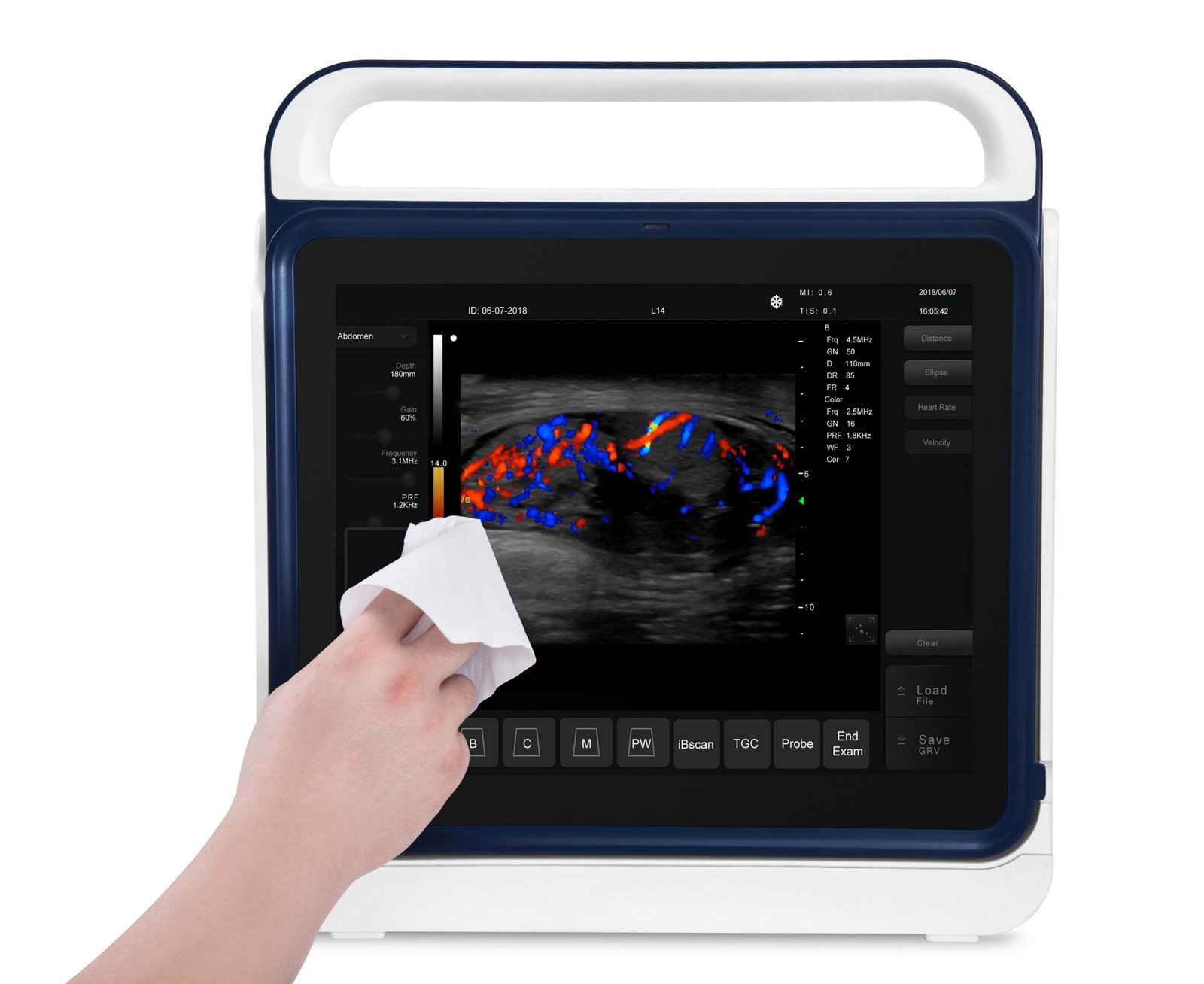 Pad Touch Veterinary Series Ultrasound System Machine NEUVU45