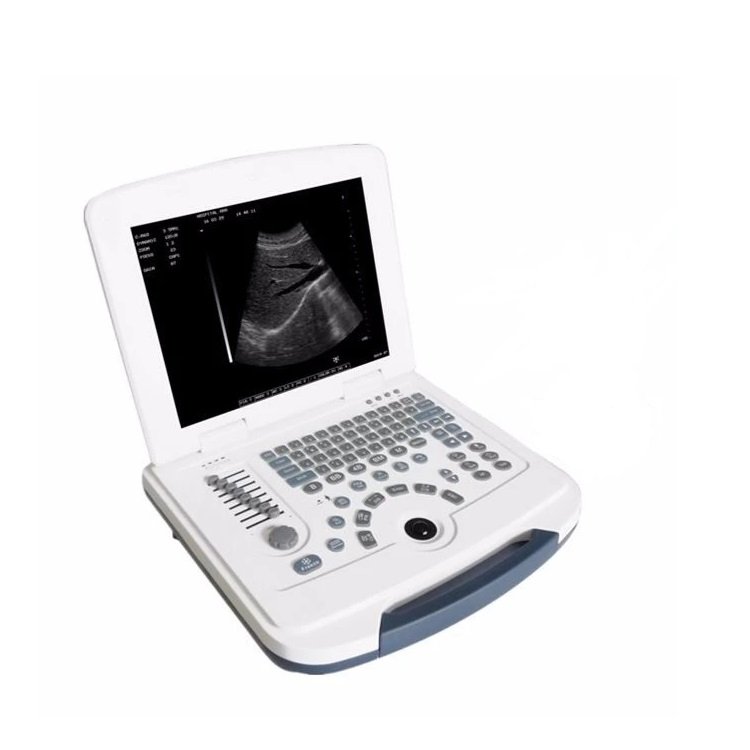 First-Class Digital Imaging B/W Ultrasound Machine MEK-580