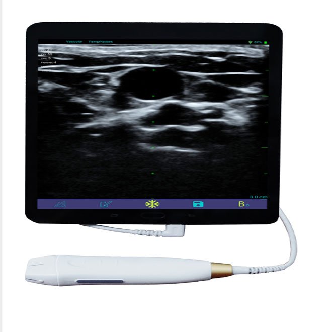 Portable Mini Ultrasound Machine NEUMU09