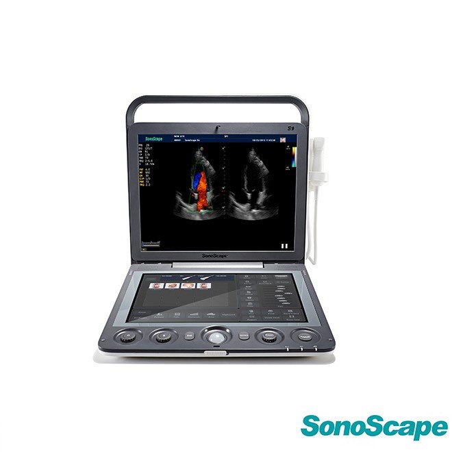 Color Doppler Ultrasound SonoScape S9