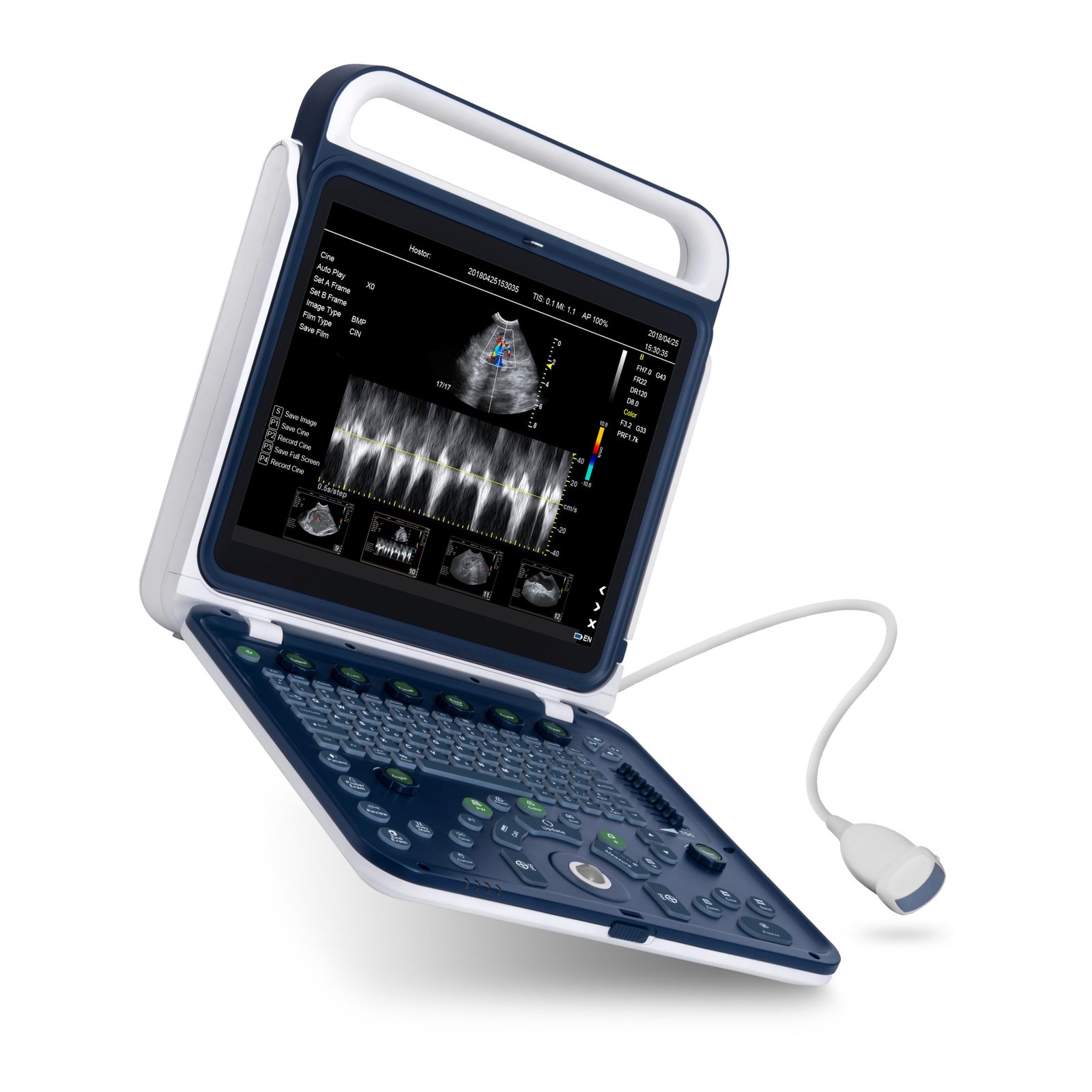 Hand Carried Color Doppler Ultrasound Machine For Vet NEUVU41