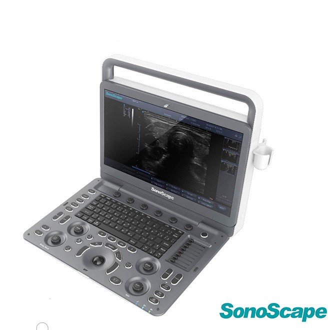 Doppler Ultrasound System Sonoscape E3
