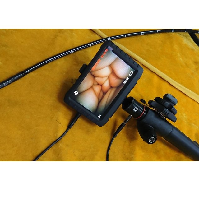 Multifunctional Portable Video Gastroscope Machine NEUVF02