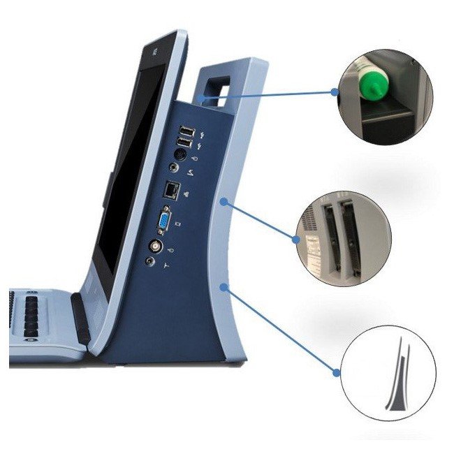 Diagnostic Ultrasound System U60
