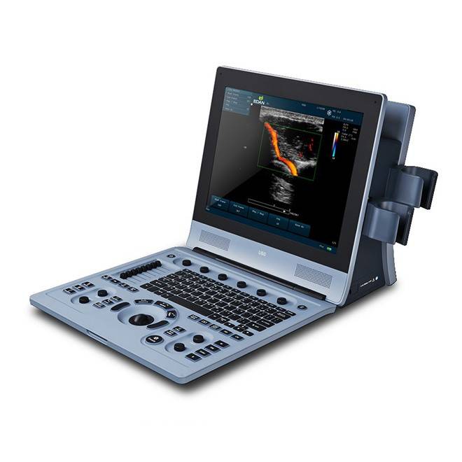 Diagnostic Ultrasound System U60