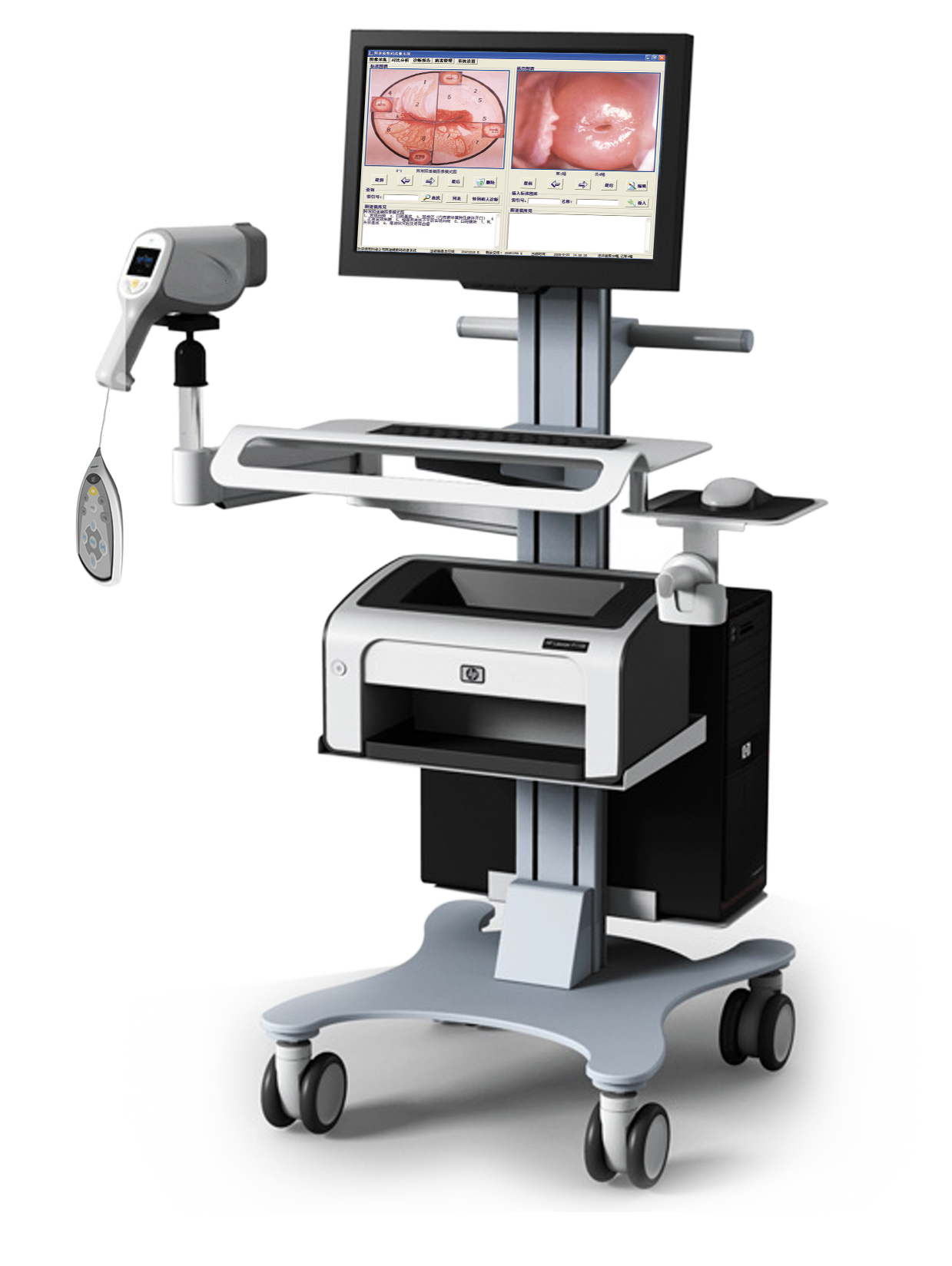 Multi-functional Trolley Colposcope Video Machine NEUCE08