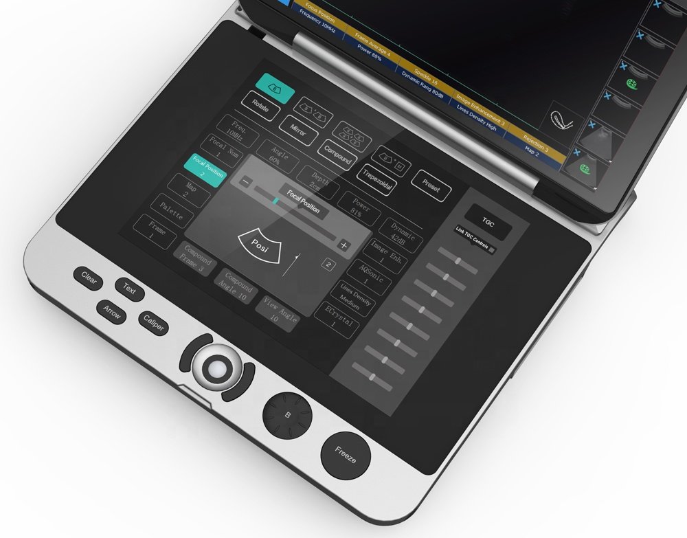 Laptop Ultrasound Machine with Touch Screen Keyboard NEUPU44