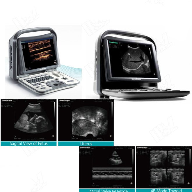 Portable Ultrasound SonoScape A5