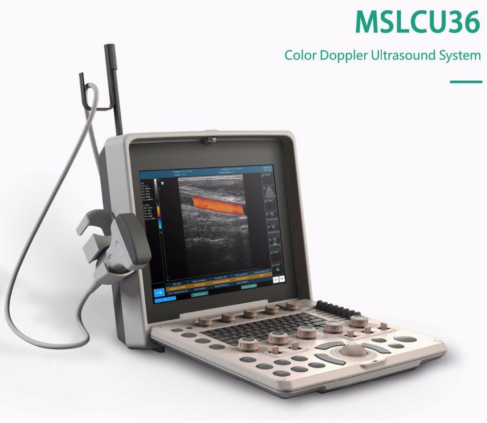 Color Doppler Ultrasound NEUCU36