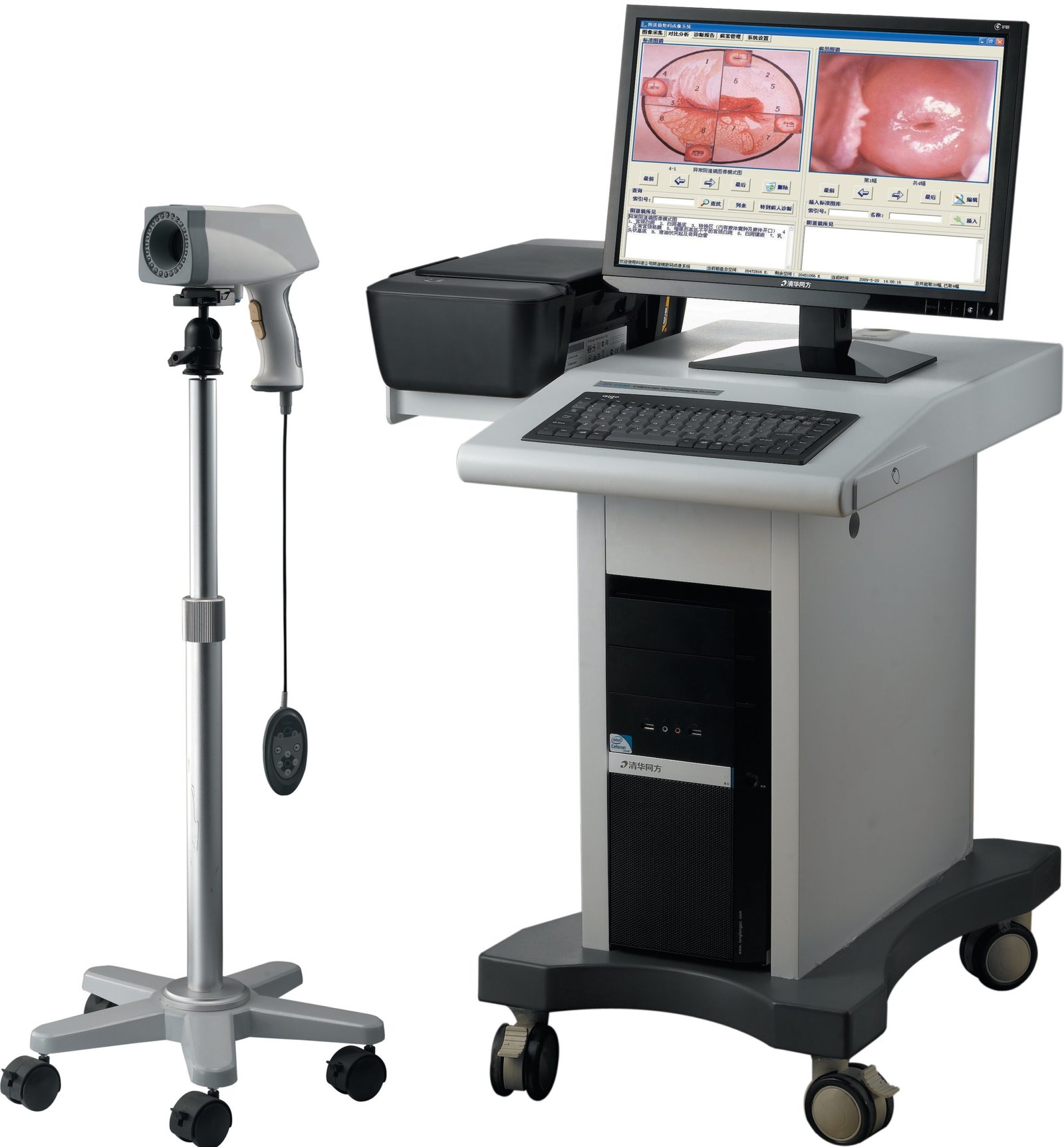 Colposcope Video Machine for Gynaecology NEUCE06