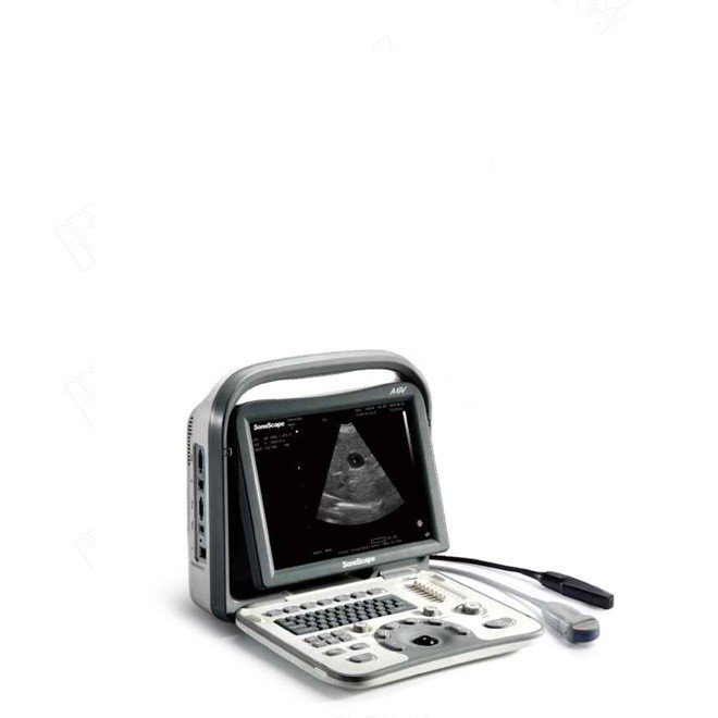 Veterinary Ultrasound SonoScape A6v