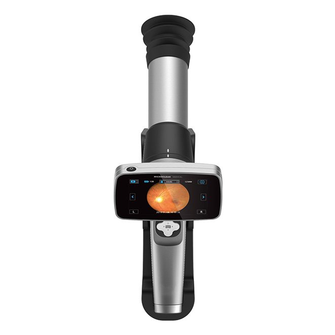 Handheld Digital Imaging Portable Fundus Camera NEUHA06
