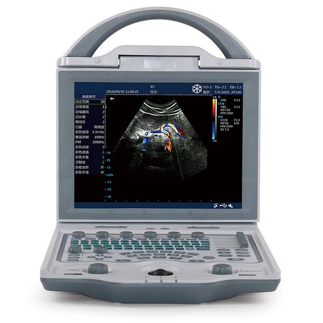 3D Ultrasound Machine NEUCU23