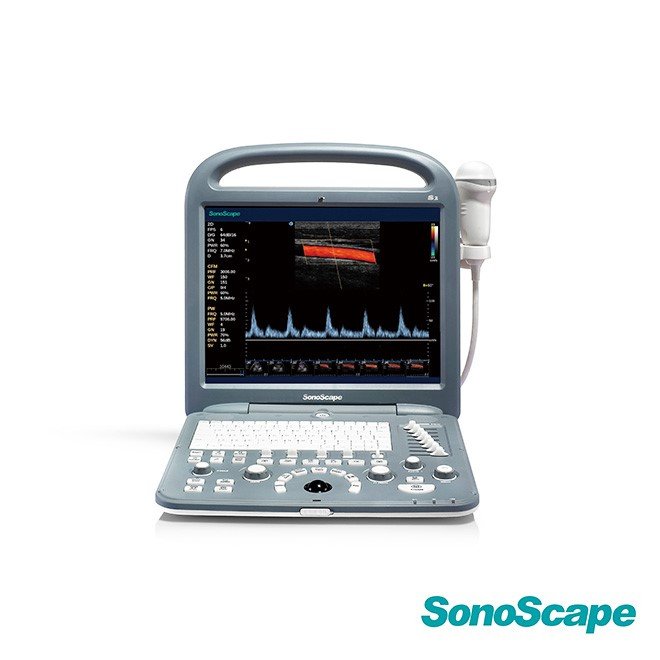 Ultrasound SonoScape S2