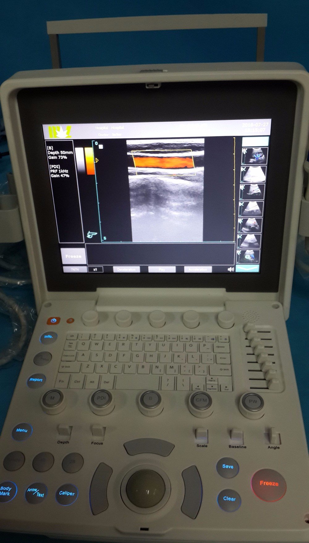 Color Doppler Ultrasound NEUCU36